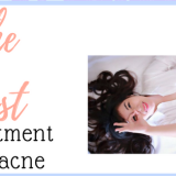 What Is The Best Treatment For Acne