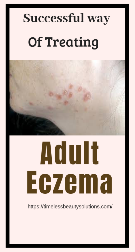 Eczema can be dry and itchy making you very uncomfortable. Find the best products to treat your eczema fast. There are remedies you can use at home.there are also eczema soaps you can use in the shower.