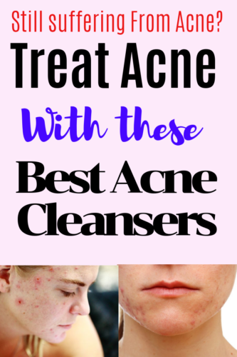 Best Acne Cleanser Reviews will look at different acne cleansers,how they work and how you should choose when buying.Learn how cleansers work and simple is the word here,,keep your skin care simple.