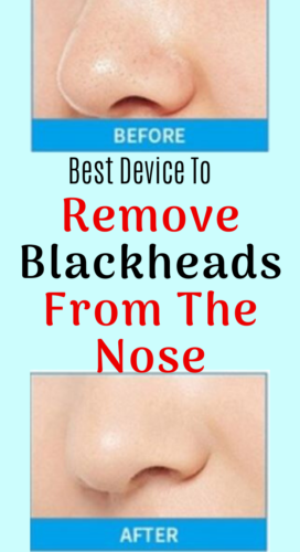 This is Remove Blackheads From The Nose