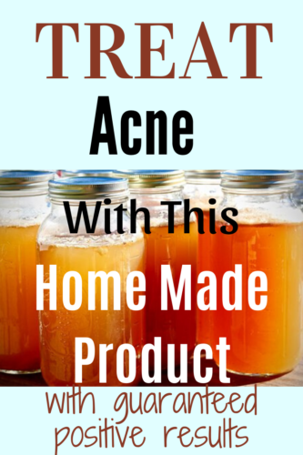 Home Remedies For Acne Treatment