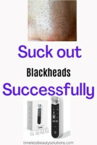 The best blackheads removal tools and products in the market