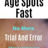 Remove Age Spots At Home With Ease