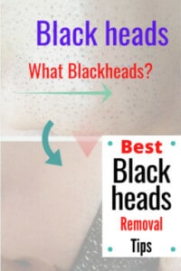 remove blackheads,clogged pores and skin imperfections caused by pores clogging using these black head removers