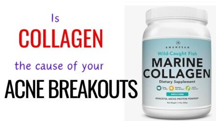 Can Collagen Supplements Cause Acne ,There is no strong evidence directly linking collagen supplements to acne.